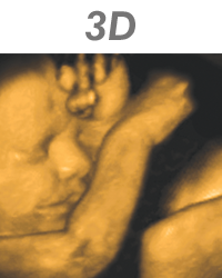 3d 4d ultrasound near me